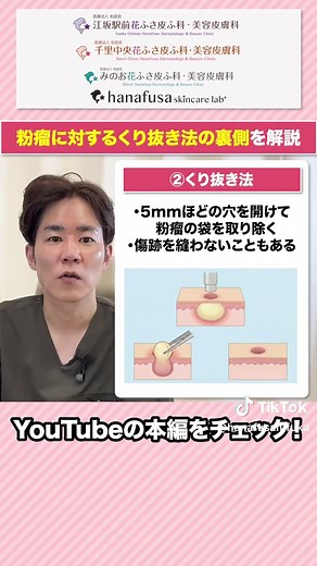 粉瘤治療のくり抜き法：知られざる真実