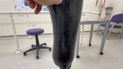 I’m always asked the same questions about my legs, which are 👇🏻 1️⃣ Why are they different on each side? 2️⃣ How do they work? The short answer is that I have different levels of amputation on each leg. My left leg is a below-knee amputation. This means I still have my knee joint and a small amount of my lower leg, although not much. Because of that, the left leg, which looks fairly basic, is essentially a carbon fibre pole with a sophisticated ankle and joint. It flexes and twists depending o