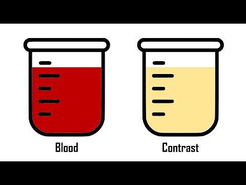 What types of contrast are used in CT scans?: Computed tomography (CT) explained