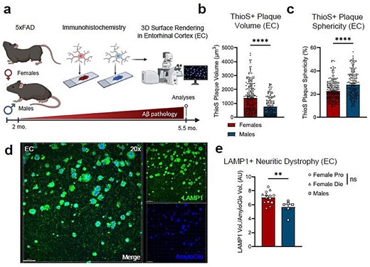 Brain immune cells may drive more damage in females than males with Alzheimer's