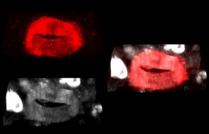 File:Synucleins-Antagonize-Endoplasmic-Reticulum-Function-to-Modulate-Dopamine-Transporter-Trafficking-pone.0070872.s010.ogv - Wikimedia Commons