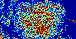 New Imaging Technique Reveals ‘Burst’ of Activity Before Cell Death