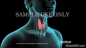 Thyroid Surgery (Thyroidectomy) on Make a GIF