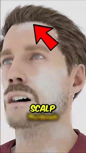 Stop Scratching! The Shocking Truth About Dandruff That Could Be Causing Hair Loss