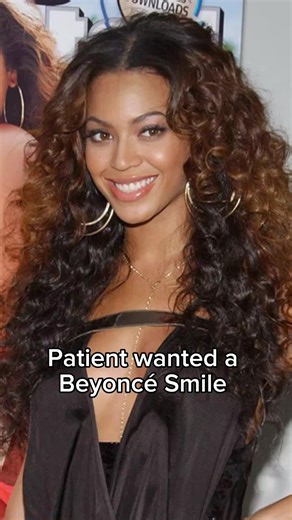 Achieve Your Dream Beyoncé Smile with Dental Veneers