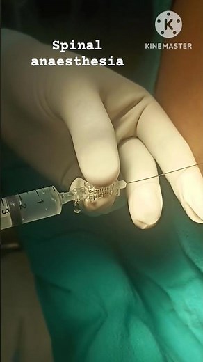 Spinal anaesthesia technique#spinal#technique#shortfeed#viralshorts#trendingshorts