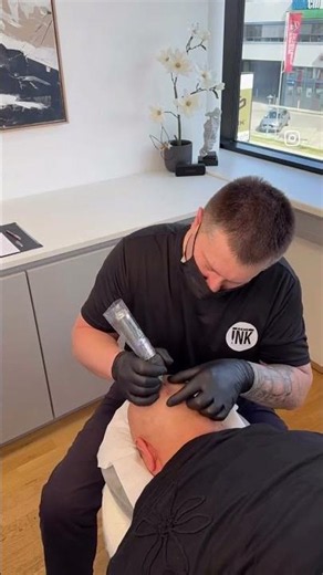 Glatze oder Haarverlust? Das muss nicht sein!
