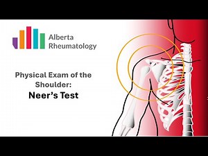 Neer's Test: Rheumatology Shoulder Physical Exam Special Tests