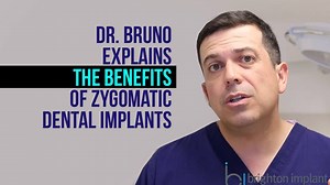 1.1K views · 22 reactions | Zygomatic implants are a type of implant used in complex dental implant treatments where patients have limited amounts of bone in the upper jaw. Instead of using bone grafting techniques, zygomatic implants can be used to bypass the need for bone grafting. Please be aware that not all cases are suitable for this dental implant solution. Dr Bruno Silva explains the differences between using zygomatic implants vs bone grafting. | Brighton Implant Clinic | Facebook