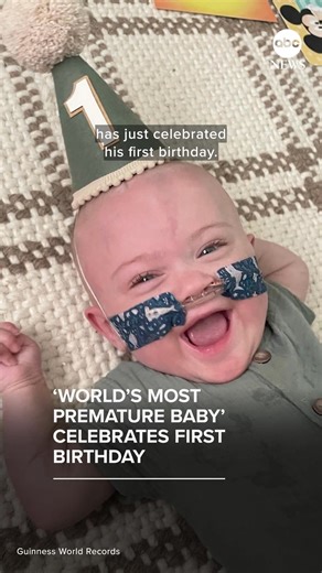 A boy who was born at 21 weeks has been named the world's most premature baby by Guinness World Records as he celebrates his 1st birthday. Read more: https://abcnews.visitlink.me/9yMke8 | ABC News
