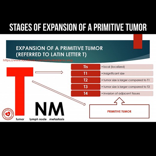 Stages of expansion of a primitive tumor #tumor #Cancer | About health and science in simple words