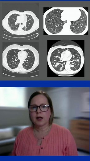3.5K views · 27 reactions | Dr. Fell shares how CT scans are a vital...