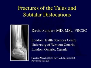 Fractures of the Talus and Subtalar Dislocations - SlideServe
