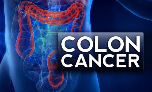 What’s the difference between bowel and colon cancer?