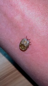 476K views · 2.9K reactions | Tick' s life cycle | OLE' CH | Facebook