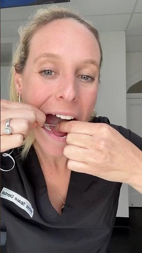 How to floss the molars in the back. #flossing #dentisttips #flossingtips