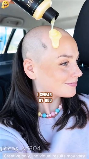 Tired of slow-growing, thin, flat hair that makes you look bald? This Tgideas Rosemary Hydrolyzed Keratin Shampoo solves your hair volume anxiety in one go! 🌿With the double power of rosemary hydrolyzed keratin, it boosts hair growth quickly—just check the before-and-after comparison: thin, fine strands turn thick and voluminous in no time!Want to ditch the "hair volume crisis" and grow fluffy, full hair? Grab it now and watch your hair grow "in a flash"! 💇‍♀️ See less | beazonbazaar.YN