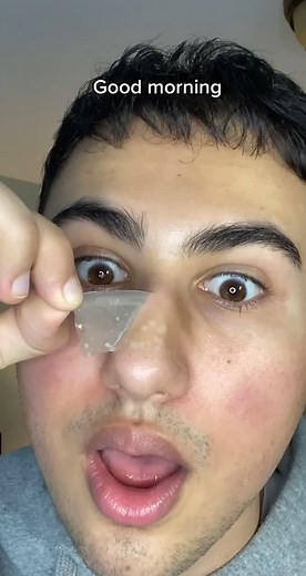 Skin Sympathy Mighty Patch Surface Oil and Sebaceous Filament Extraction