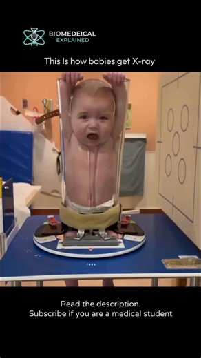 Biomedical Explained on Instagram: "This Baby X-Ray Machine Will Shock You 🤯 In this video, we explain how hospitals safely X-ray infants using a device called the Pigg-O-Stat, which keeps babies still without exposure to harmful restraints. 📌 What you’ll learn in this video: ✔ Why movement ruins X-ray images in infants ✔ How the Pigg-O-Stat immobilizes babies safely ✔ Why this method reduces repeat radiation exposure Infants move a lot, and even slight motion can blur X-ray images, making it 