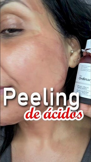 Powerful exfoliation. The Ordinary's Peeling Solution 30% AHA + 2% BHA for deep exfoliation