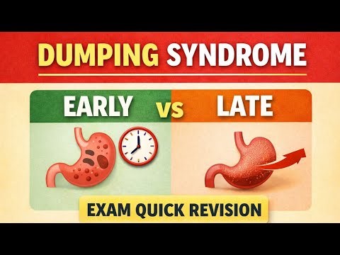 Dumping Syndrome Explained | Early vs Late Dumping | Quick Revision for Exams