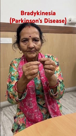 Bradykinesia- Slowness in body in Parkinson’s Disease | Mask like Face #parkinson #neurologist