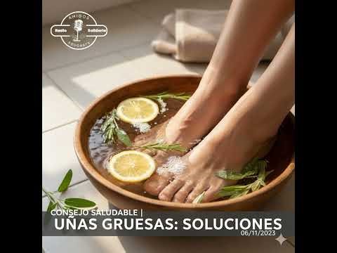 Uñas gruesas y curvadas: Claves para la Onicogrifosis - Consejos Saludables (06-11-2023)