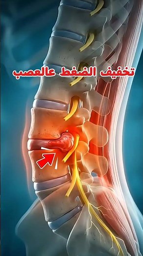 تخفيف الضغط على عصب الديسك بطريقة علمية ✅