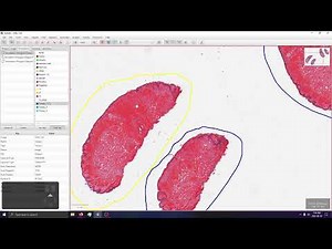 Multi-Section analysis in QuPath