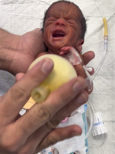 26 weeks baby cry after 10 days #newborn #unfreezemyaccount