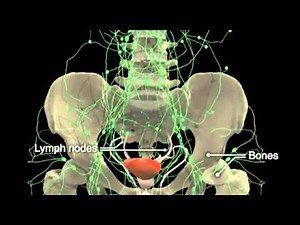 How Prostate Cancer Develops in Prostate Gland • Video • MEDtube.net