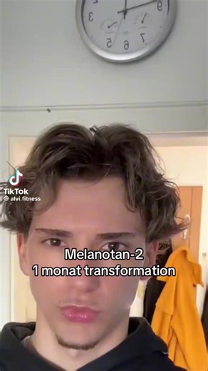 Melanotan 2: A Looksmaxxing Guide