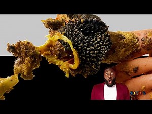 The thickness and super long length of these toenails is amazing👣 Fungal Toenails【Xue Yidao】👣7965674