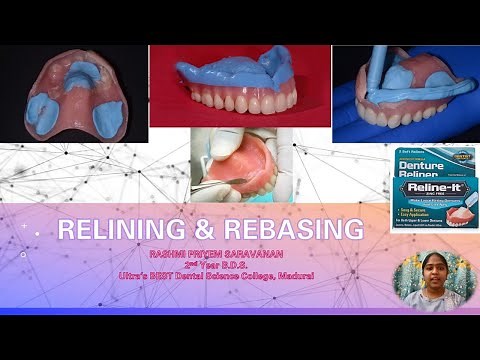 Relining and Rebasing of Dentures | Complete and Partial Denture | Methods | Steps Involved | Reline