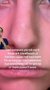 3.9M views · 98K reactions | How to remove sebaceous filaments like a...