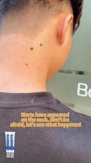 36 reactions | 濫Tired of hiding old scars, acne marks, or stretch...