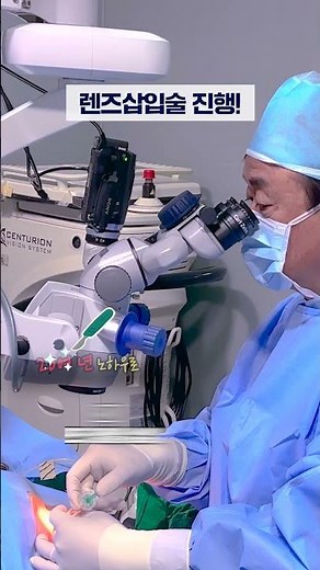 렌즈삽입술(ICL) 어떻게 진행될까? 수술실 리얼 과정 30초 미리보기 ⏱️👀
