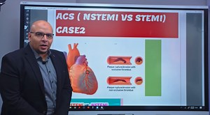 ا🔥شاهد الفرق مابين STEMI VS NSTEMI بشرح د.عمرو محمد الاستثنائى كما لم تسمع من قبل😲😲!! و التاكيد من د.عمرو (العلاج الاساسى لجلطات القلب هو (القسطره )والعلاج الدوائى له ظروف معينه وهذا حسب ESC ..NICE GIDELINES )!!!🔥🔥🔥. ا🔥شارك برأيك فى حالات مماثله و تواصل مع المنسقه للاشتراك فى كورس MRCP الخاص بدكتور عمرو الذى يعتمد على اعدادك كطبيب عن طريق الفهم CONCEPTS و بعيدا عن حفظ بنوك الاسئله !! ا🔥شارك فى الكورس الاكثر نجاحا بعدد الناجحين و الريفيوهات مهما كنت متوقف او لك محاولات سابقه فاشله ومهما ك