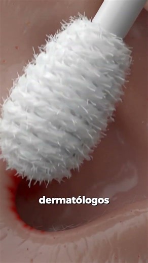 El Error de los Hisopos 😳