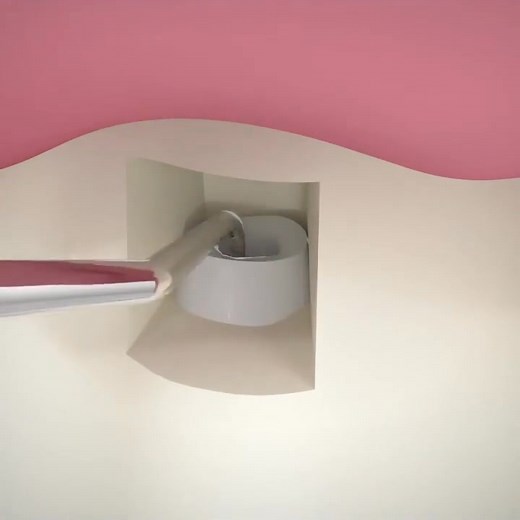 Apicoectomy #Dentistry #LearningTips #BitesnBraces #smile #medical #People #dentista #Tooth #Implant #Dental #dentist | Bites & Braces Dental