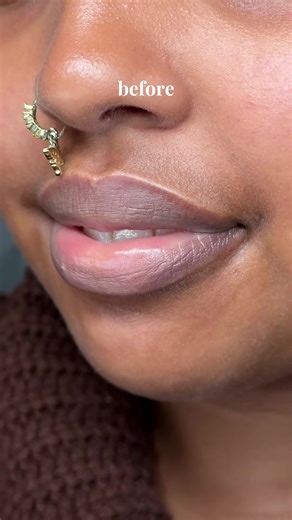 How to Solve Common Lip Problems Effectively