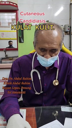Understanding Cutaneous Candidiasis at Klinik Abdul Rahim