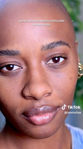 O Silymarin CF: O Melhor Antioxidante para Pele com Oleosidade e Acne
