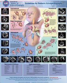 Amazon.com: Guidelines and Standards for Performance of a Pediatric Echocardiogram Poster (ASE Guidelines Posters): American Society of Echocardiography: Libros