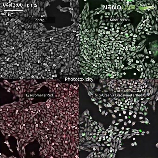 𝗗𝘆𝗲𝘀 𝘀𝘁𝗿𝗲𝘀𝘀 𝗰𝗲𝗹𝗹𝘀. 𝗪𝗲 𝗱𝗼𝗻’𝘁.