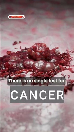 Tests to Check If You Have Cancer | Early Detection Saves Lives | Medical Vault