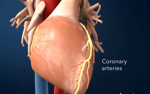 3分钟让你了解心脏支架手术。