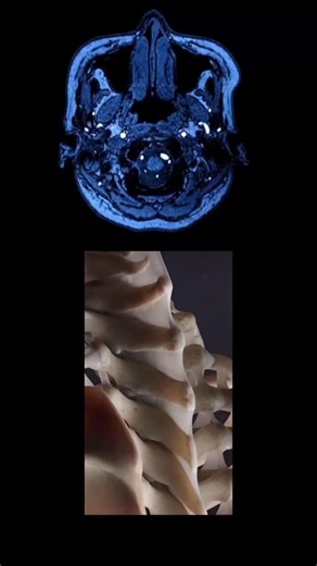 @mindscape.doc on Instagram: "☢️ PART 01 Radiology explained #radiology #medecine #ctscan #mri"