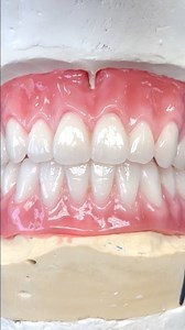 61K views · 257 reactions | Upper and Lower Screw-Retained Wax Try-In! Case from Dr. Lance Dehne in Michigan! | Luke Kahng | Facebook