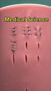 1.4M views · 10K reactions | #Part_5 #Running_Locking_Suture #medical #science #virals | Medical Science | Facebook